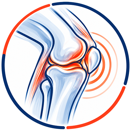 icon-relieve-pain-knee Knee Pain